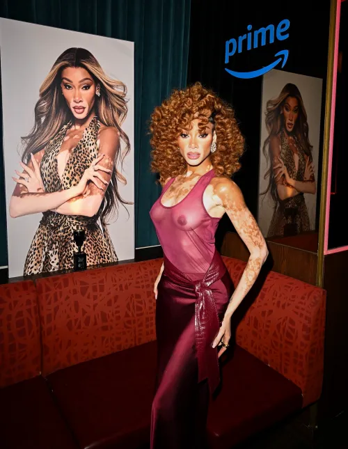 Winnie Harlow