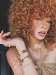 Winnie Harlow - Winnieharlow
